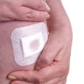 Gauze Dressings vs Gauze Pads: Understanding the Differences for Effective Wound Care