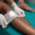 The Truth About Gauze: An Expert's Perspective on Wound Care