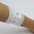 The Versatility and Importance of Gauze Bandages