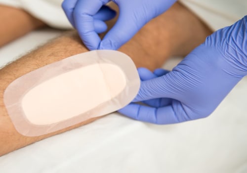 The Best Dressings for Open Wounds: An Expert's Perspective