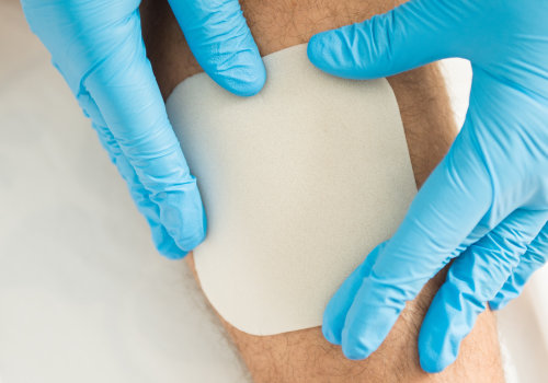 The 5 Essential Rules of Wound Dressing: A Comprehensive Guide for Healthcare Professionals