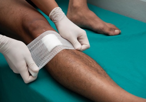 The Ultimate Guide to Wound Dressings: Types, Uses, and Recommendations